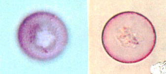 石川県医師会 医師のみなさま 花粉情報 令和３年スギ ヒノキ花粉情報