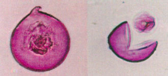 石川県医師会 医師のみなさま 花粉情報 令和３年スギ ヒノキ花粉情報
